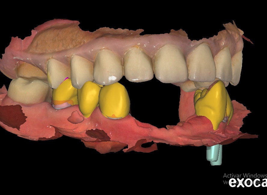 Innovación en Odontología en Quito con Tecnología CAD-CAM